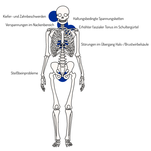 Funktionelle Ursachen von Spannungskopfschmerzen